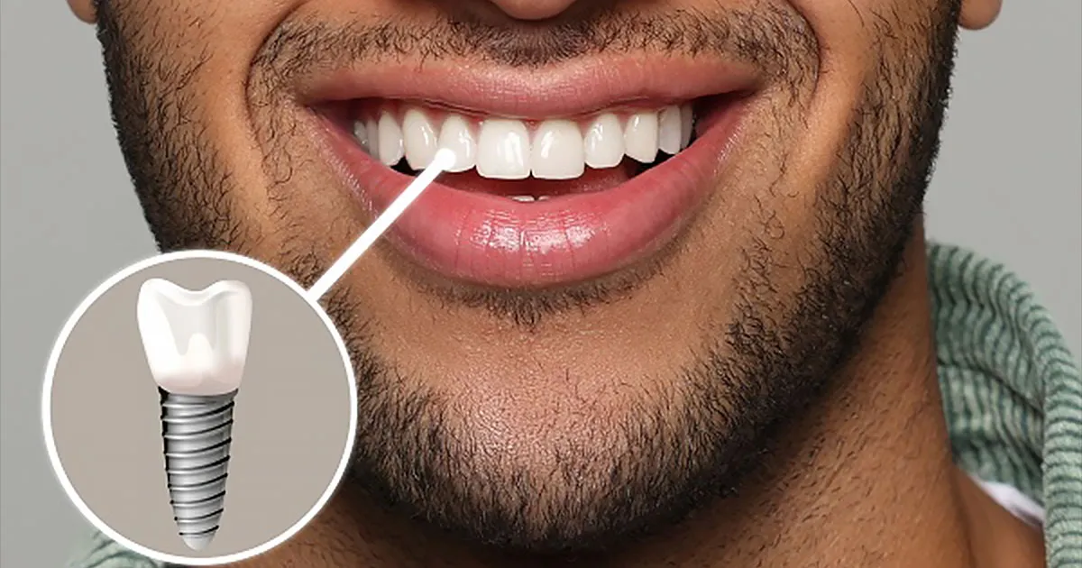 چرا ایمپلنت دندان فقط یک درمان زیبایی نیست؟