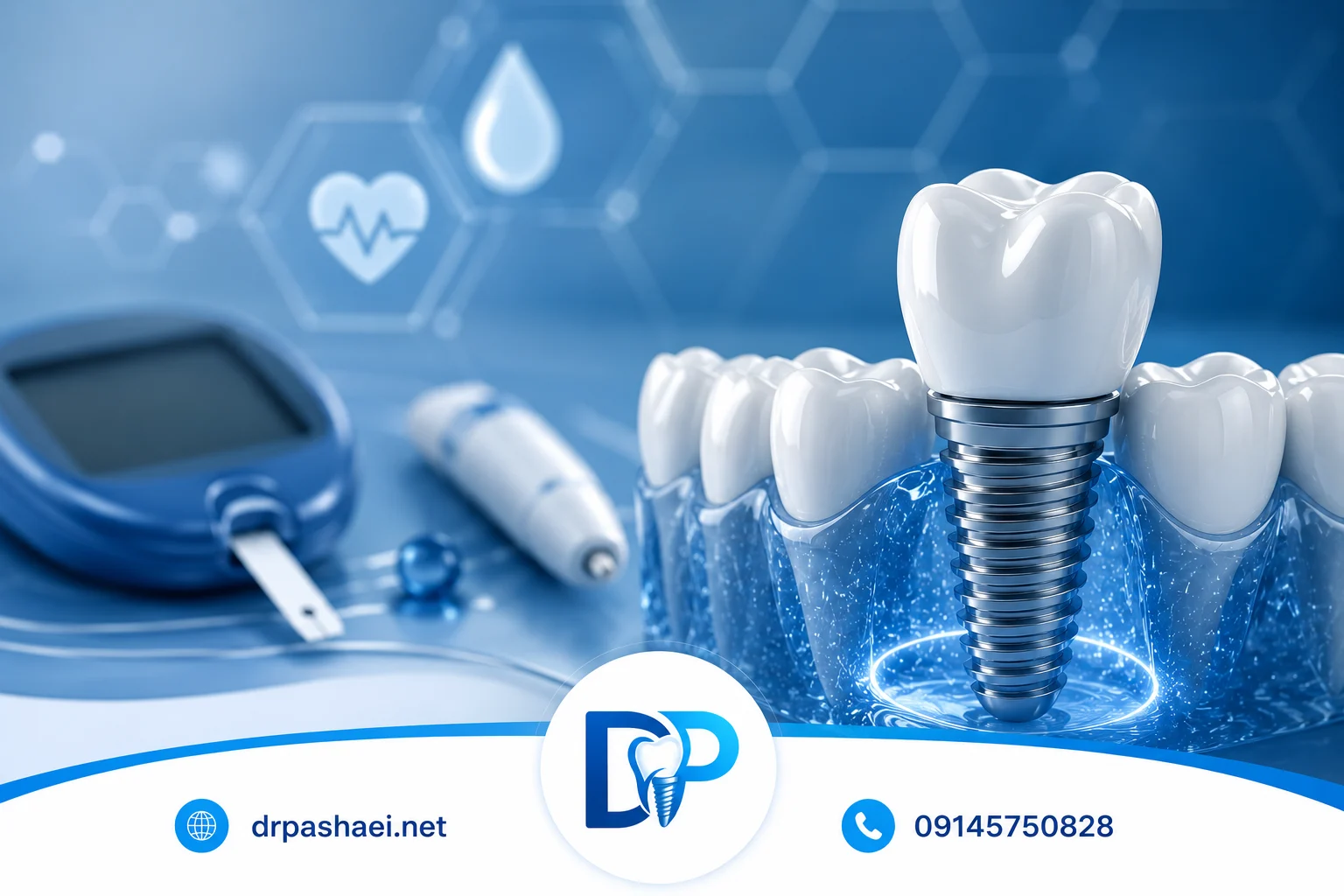 بازسازی کامل فک برای بیماران دیابتی